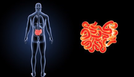 כריתת המעי הדק - תמונת אווירה